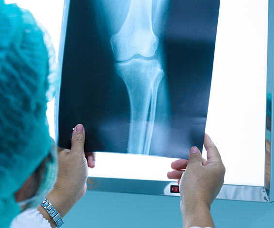 Digital-X-Ray